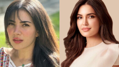 Hamza Ali Abbasi's Sister Sets the Record Straight on Naimal Khawar's Surgery Rumors